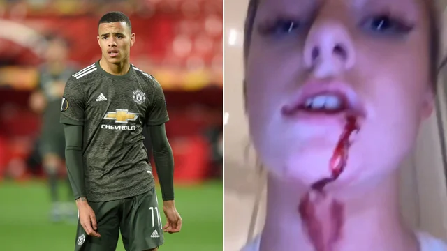Arrestato il calciatore del Manchester United Greenwood: la fidanzata mostra foto e video di violenze