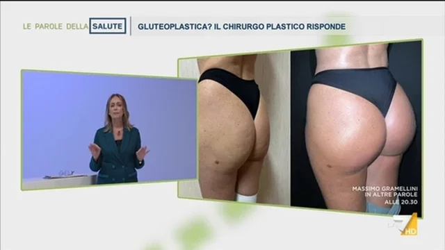 Gluteoplastica? Il chirurgo risponde