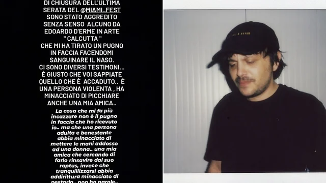 "Calcutta mi ha tirato un pugno in faccia e ha minacciato una mia amica": la denuncia del cantante De Leo