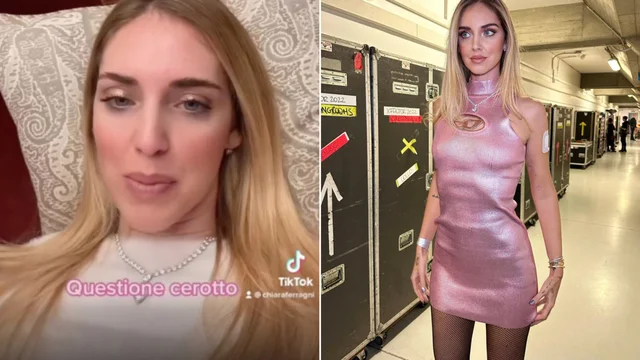 Chiara Ferragni e il mistero del cerotto sul braccio: "Ora ve ne posso parlare"