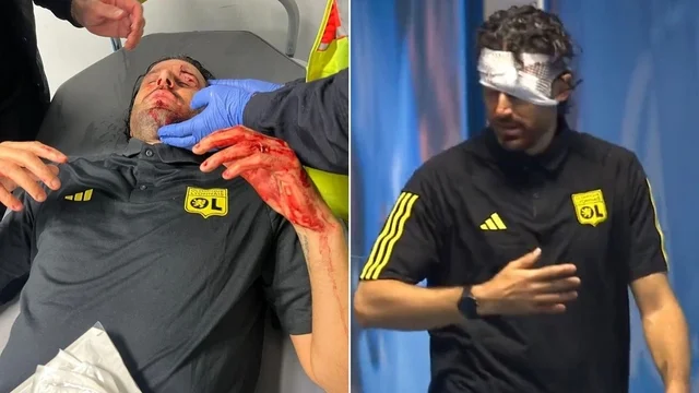 Fabio Grosso è rimasto gravemente ferito dopo che il pullman della sua squadra è stato attaccato con delle pietre